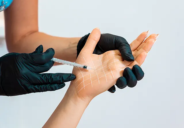 excessive sweating treatment in London