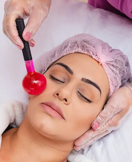 fire and ice facial treatment in London