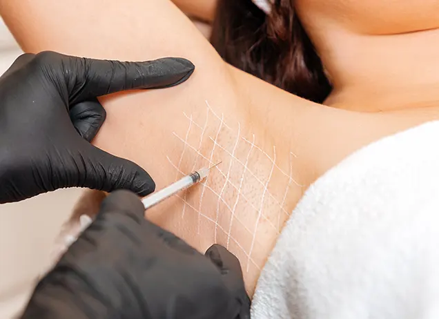 hyperhidrosis treatment in Chelsea