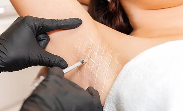 Laser facial treatment in London