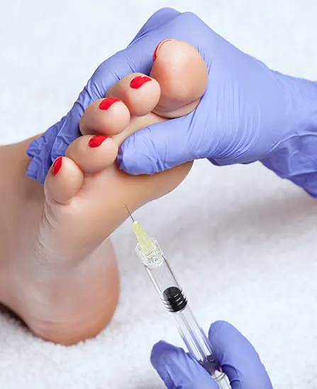 Laser treatment in UK